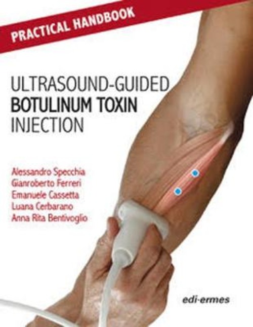 Practical handbook for ultrasound-guided botulinum toxin injection