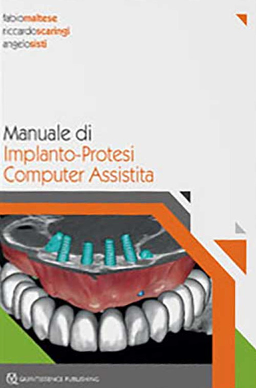 Manuale di implanto-Protesi computer assistita