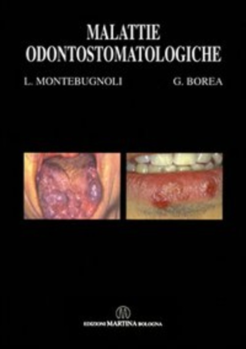 Malattie odontostomatologiche