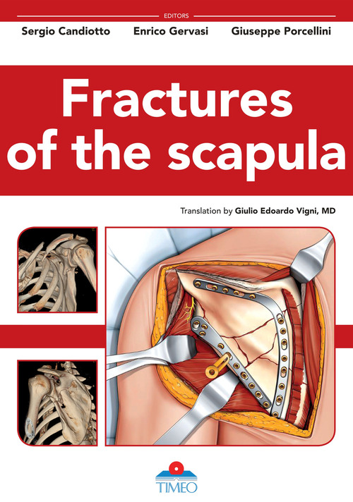 Fractures of the scapula