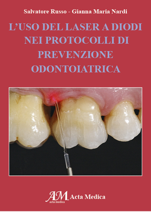 L'uso del laser a Diodi nei protoccolli di prevenzione odontiatrica