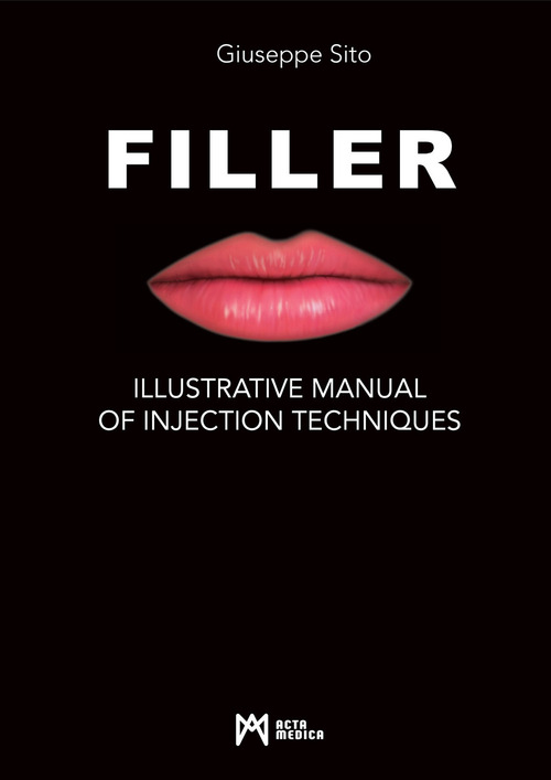 Filler. Illustrative manual of injection techniques