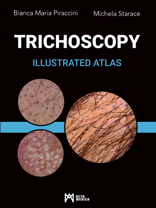 Trichoscopy. Illustrated atlas